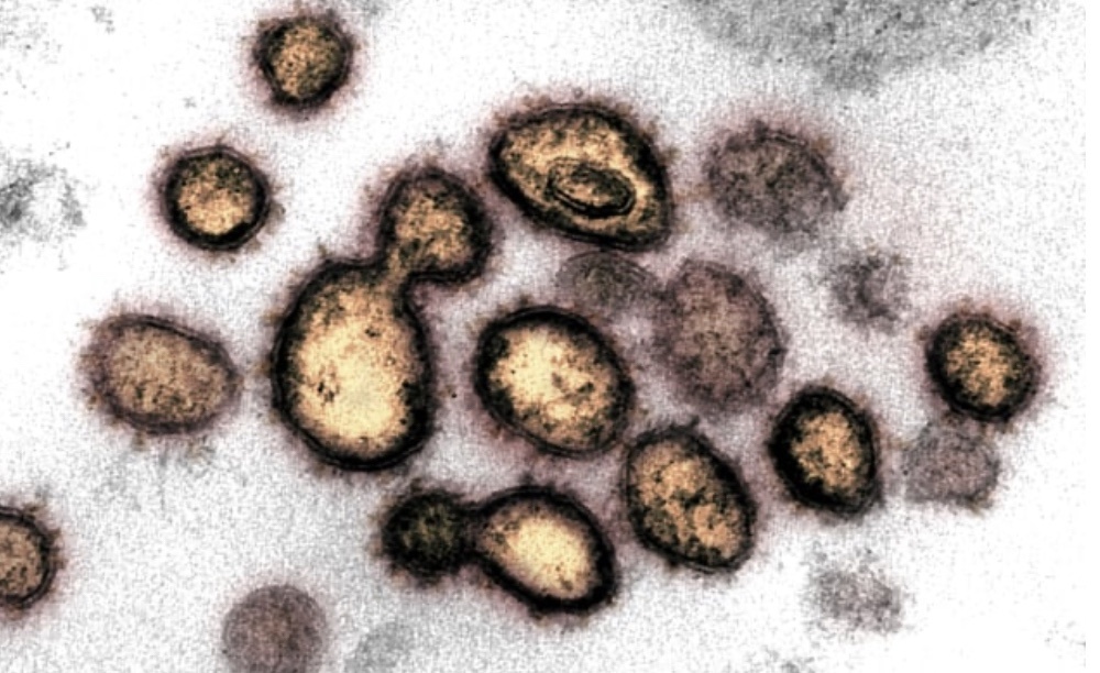 Foto Foto Virus Corona Saat Direkam Mikroskop