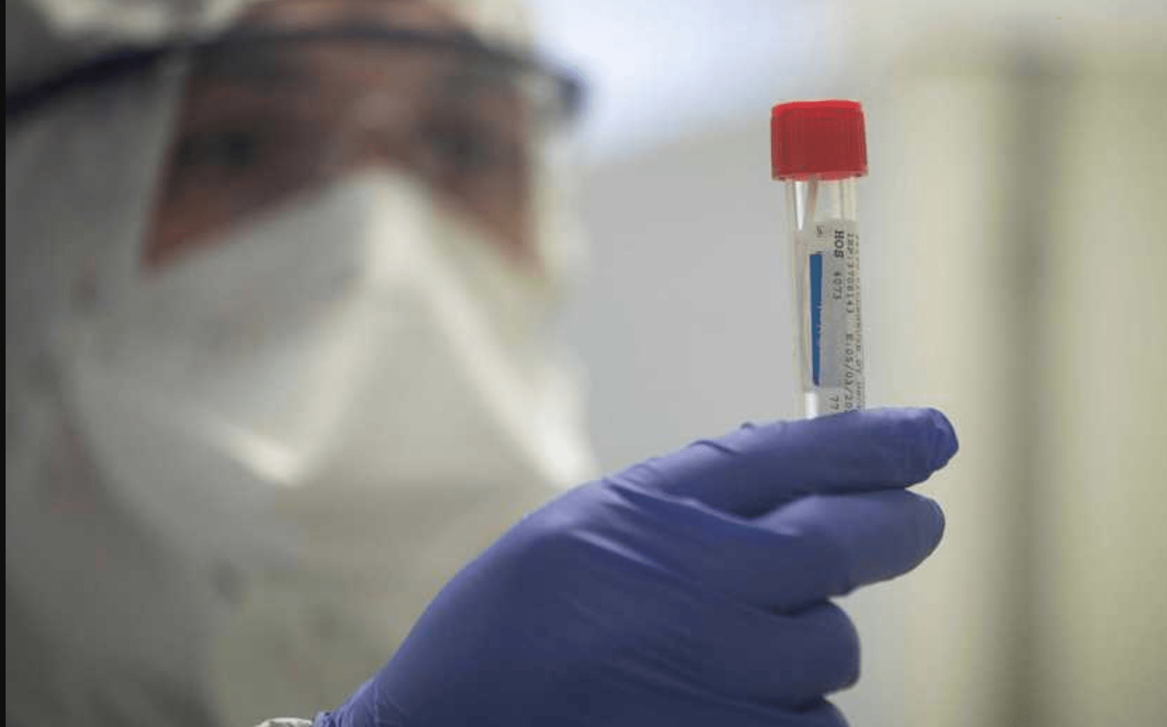 Ini Riwayat Kontak Pasien Positif Covid-19 Asal Borobudur