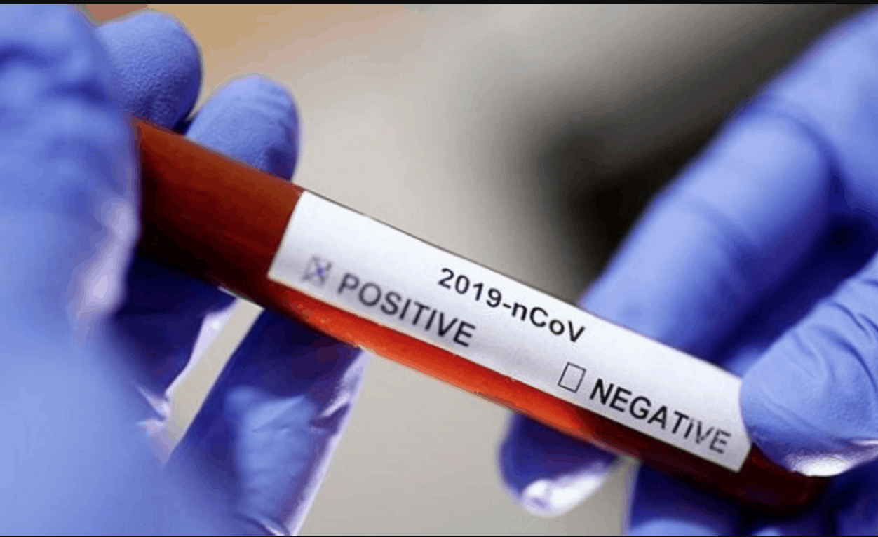 IlUSTRASI : Hasil swab positif covid-19
