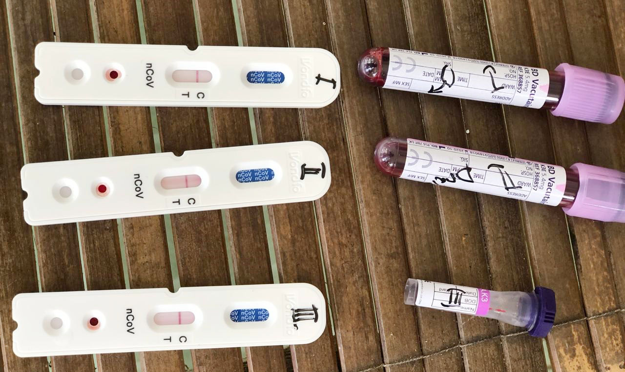 ILUSTRASI : Hasil tes SWAB