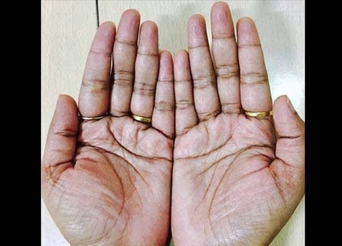 Cek Garis Tanganmu, Ini Makna dan Penjelasannya