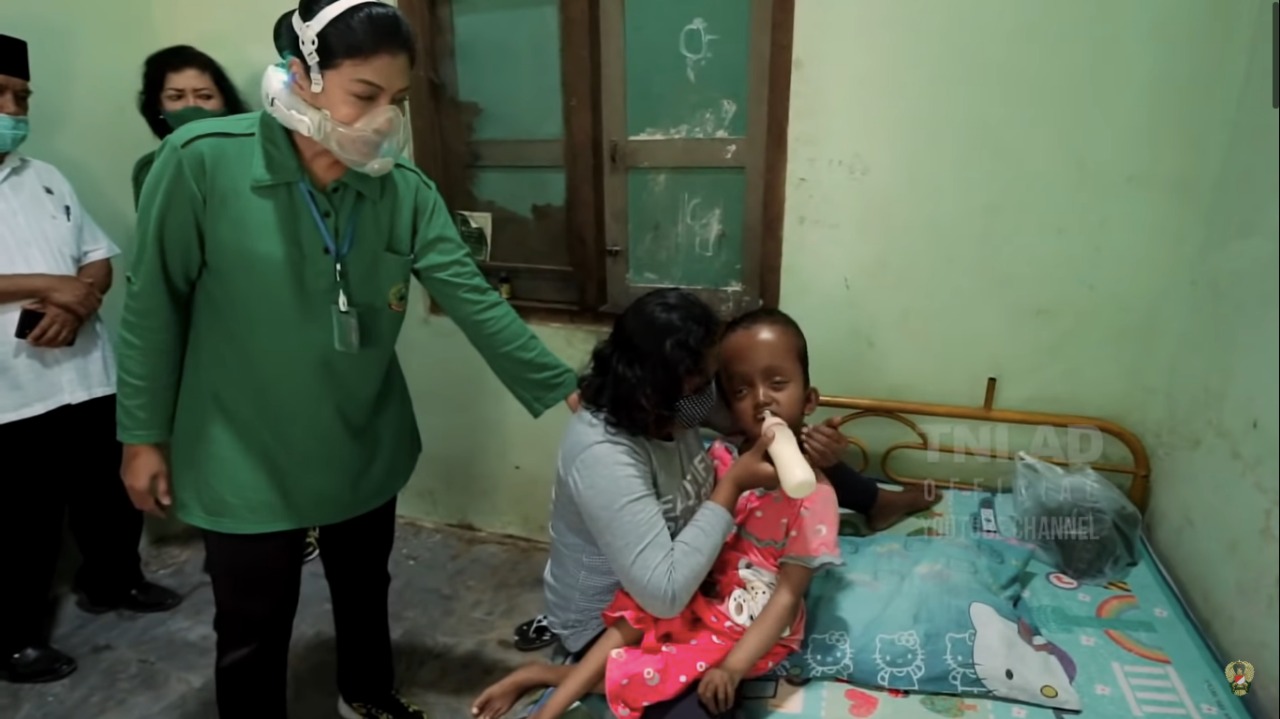 Tolong Gadis Asal Mungkid Didiagnosa Hidrosefalus