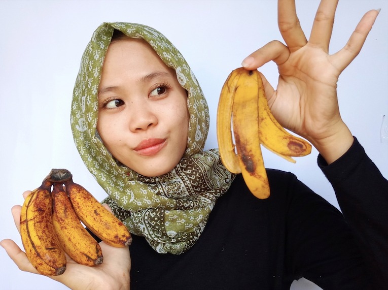 Tips Mumer Hilangkan Tahi Lalat Tanpa Operasi