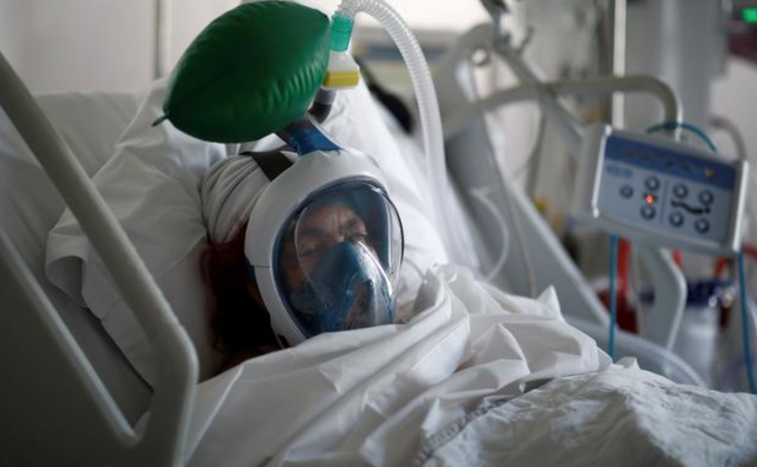 VENTILATOR: Pasien dirawat di rumah sakit saat pandemi covid-19. (foto: internet)