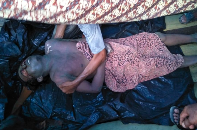 GOSONG: Kondisi korban dengan tubuh hangus akibat tersambar petir. (sumber: internet/ilustrasi)
