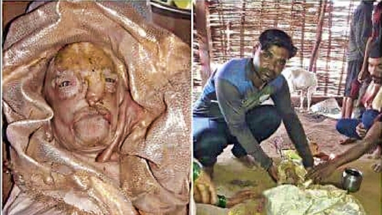 Seekor anak kambing lahir dengan wajah mirip manusia