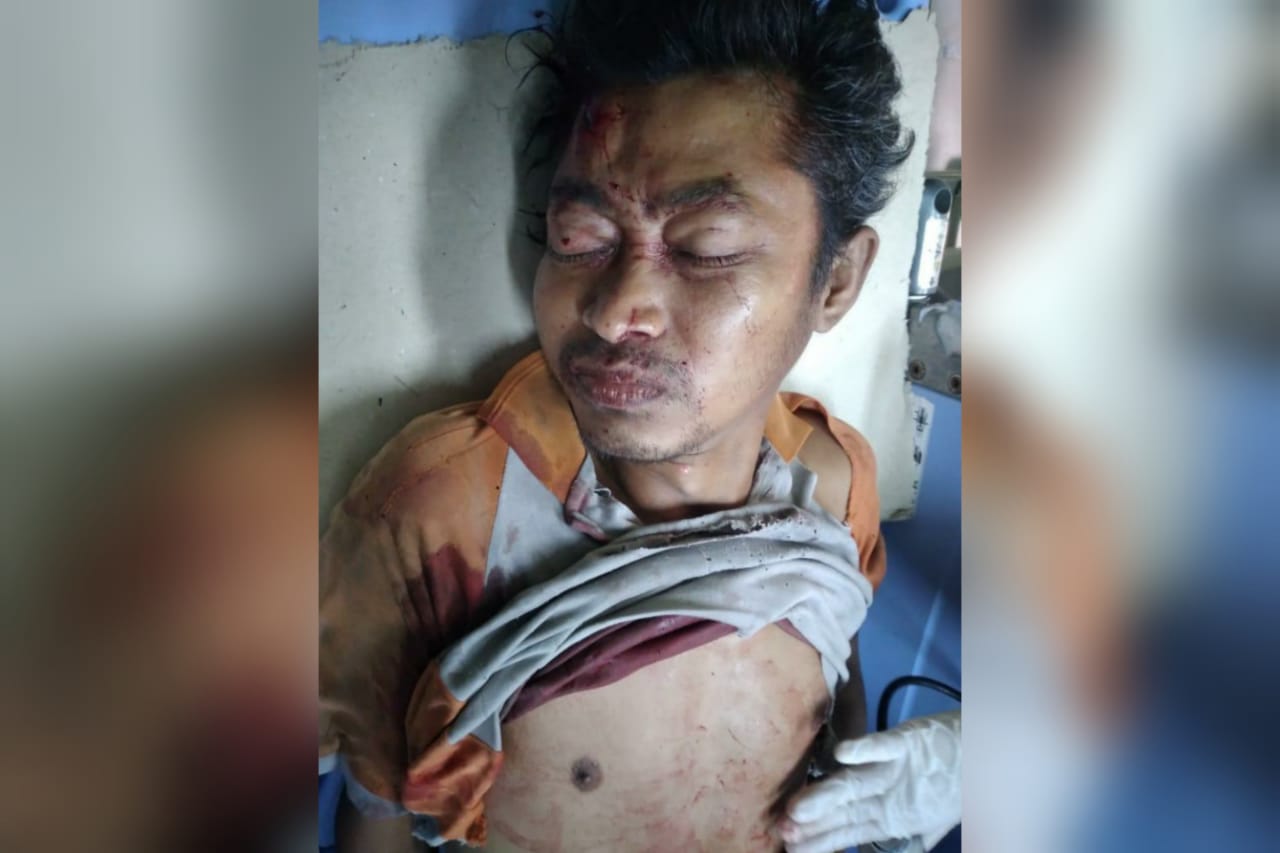 Duh…ODGJ Tanpa Identitas Mengalami Kecelakaan di Muntilan