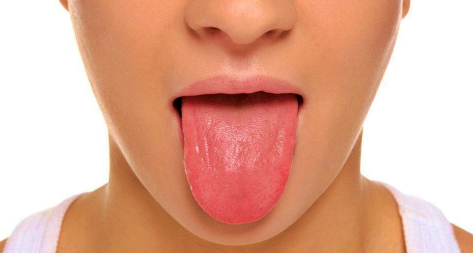 julurkan lidah untuk cek gejala diabetes