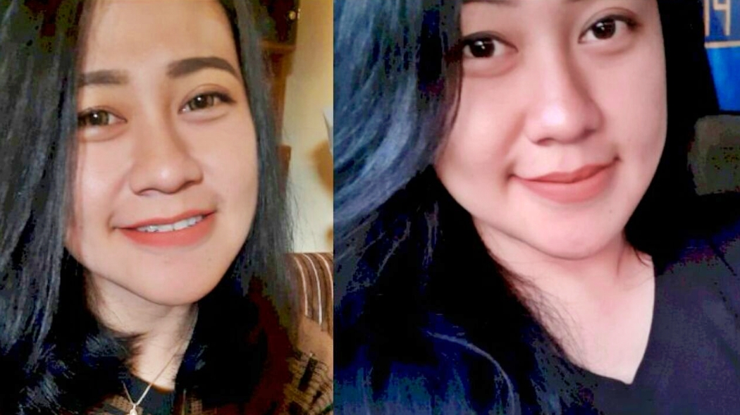 ini sosok perawat cantik dibakar