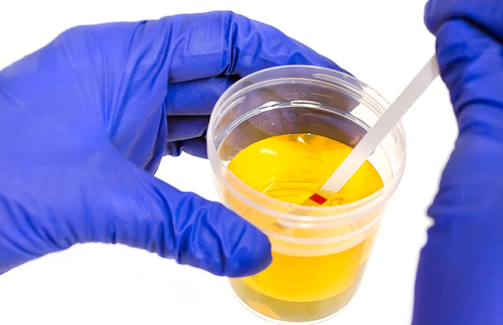 Cegah Penyalahgunaan Narkoba, Puluhan Personel Kodim 0705/Magelang Ikuti Tes Urine