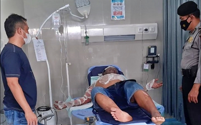 tetangga yang menjadi korban dibakar oleh pelaku yang kini buron