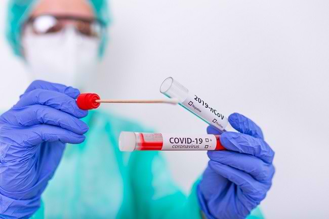 Simak! Ini Rincian Harga Rapid Test Antigen di Bandara dan Stasiun