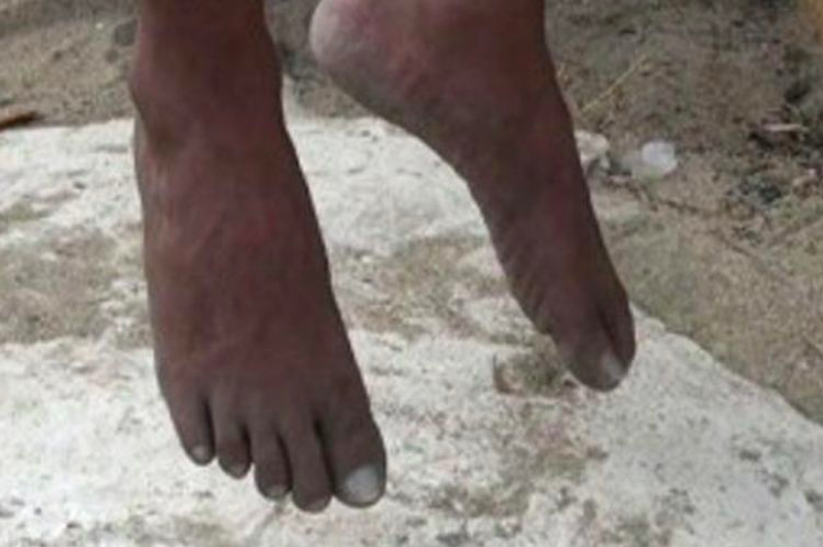 Korban bunuh diri. (gambar: ilustrasi)