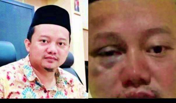 Terdakwa kasus pemerkosaan belasan santri babak belur di dalam penjara