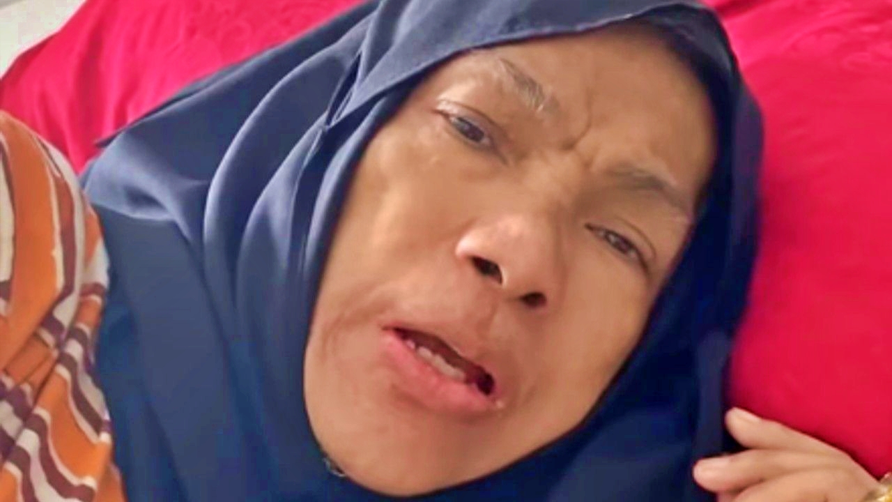 Dorce dalam kondisi sakit