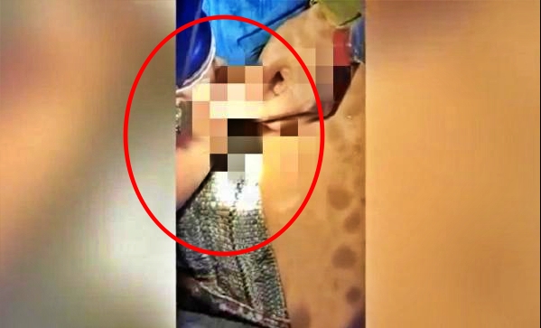 tangkapan layar video petugas damkar melepas tindik dari kelamin seorang pemuda