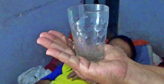 gelas yang berada dalam perut seorang pria