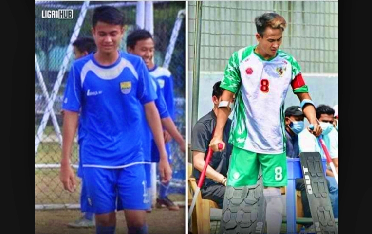 Aditya kapten timnas sepak bola amputasi Indonesia