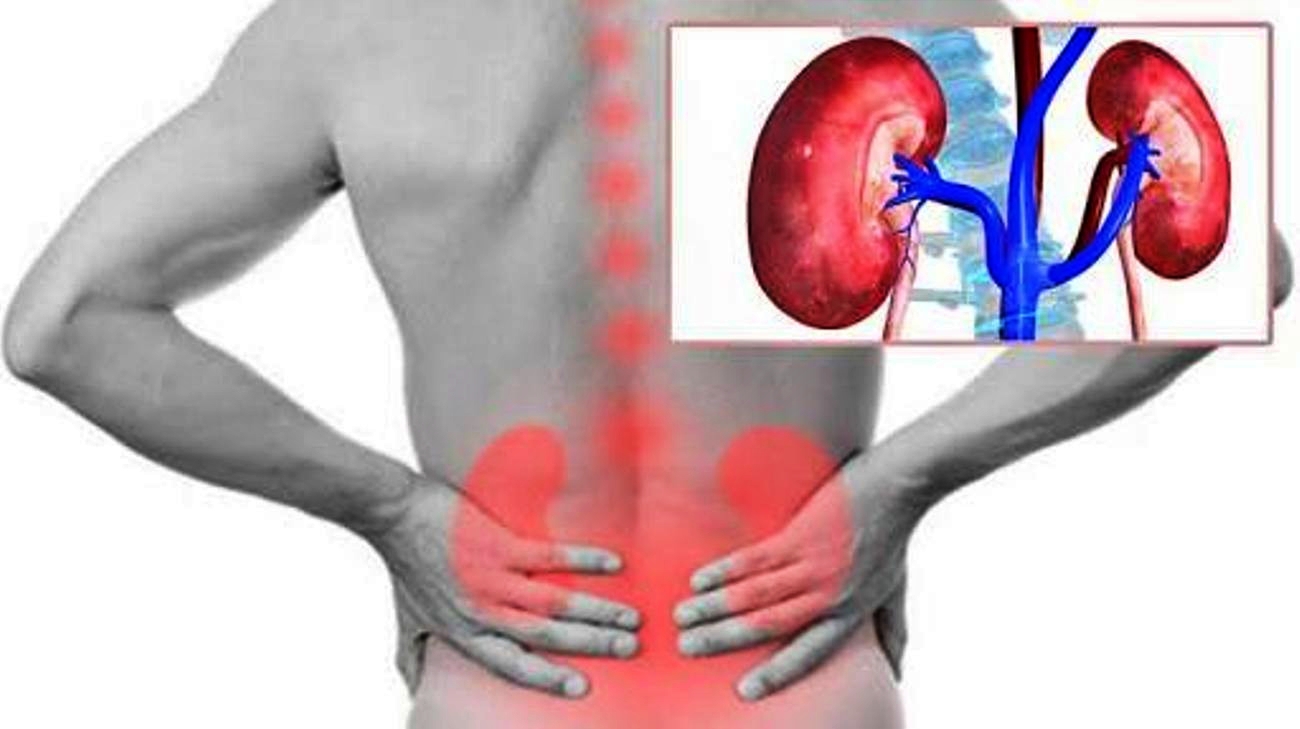 ilustrasi tanda awal gagal ginjal