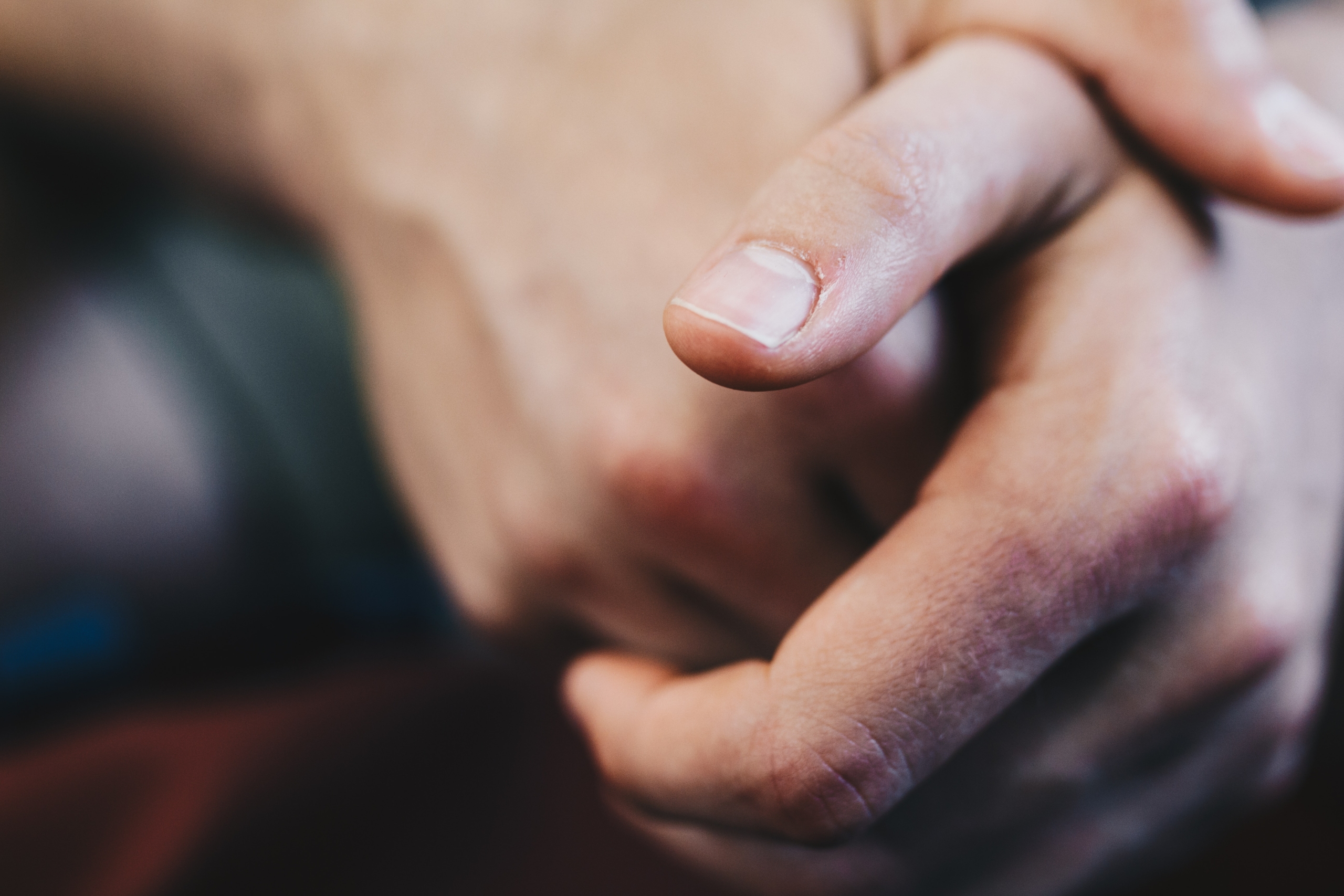 Kulit Kering pada Tangan dan Kaki? Ini Penyebab dan Cara Mengatasinya