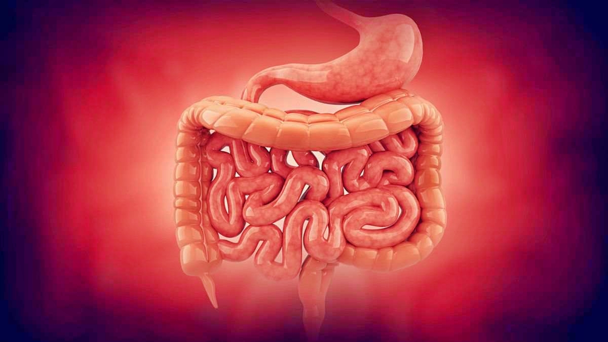 Ilustrasi infeksi usus