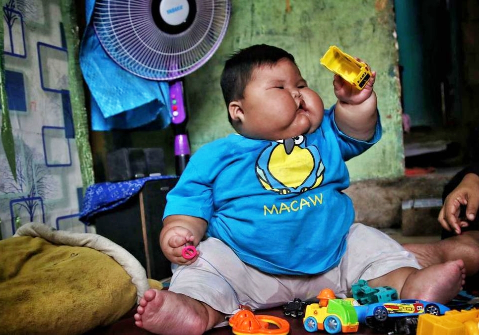 Bayi di Bekasi umur satu tahun tapi berat badan 27 kilogram