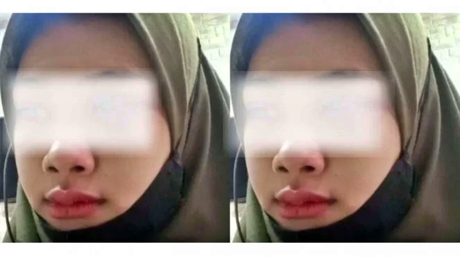 Wanita ini dianiaya suaminya sendiri karena terima vc pria lain