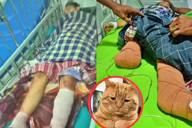 Kedua Kaki Anak SD Terlindas Truk Saat Hendak Selamatkan Seekor Kucing_foto undercover id