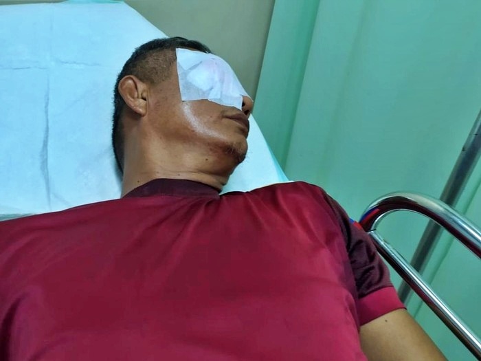 Mata seorang Guru buta setelah diketapel orang tua muridnya