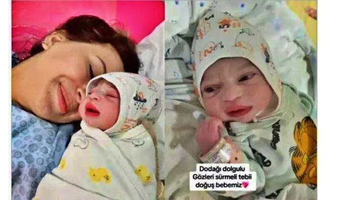 Dokter di Turkmenistan membagikan kisahnya saat membantu seorang ibu melahirkan bayi perempuan yang memiliki kecantikan alami.