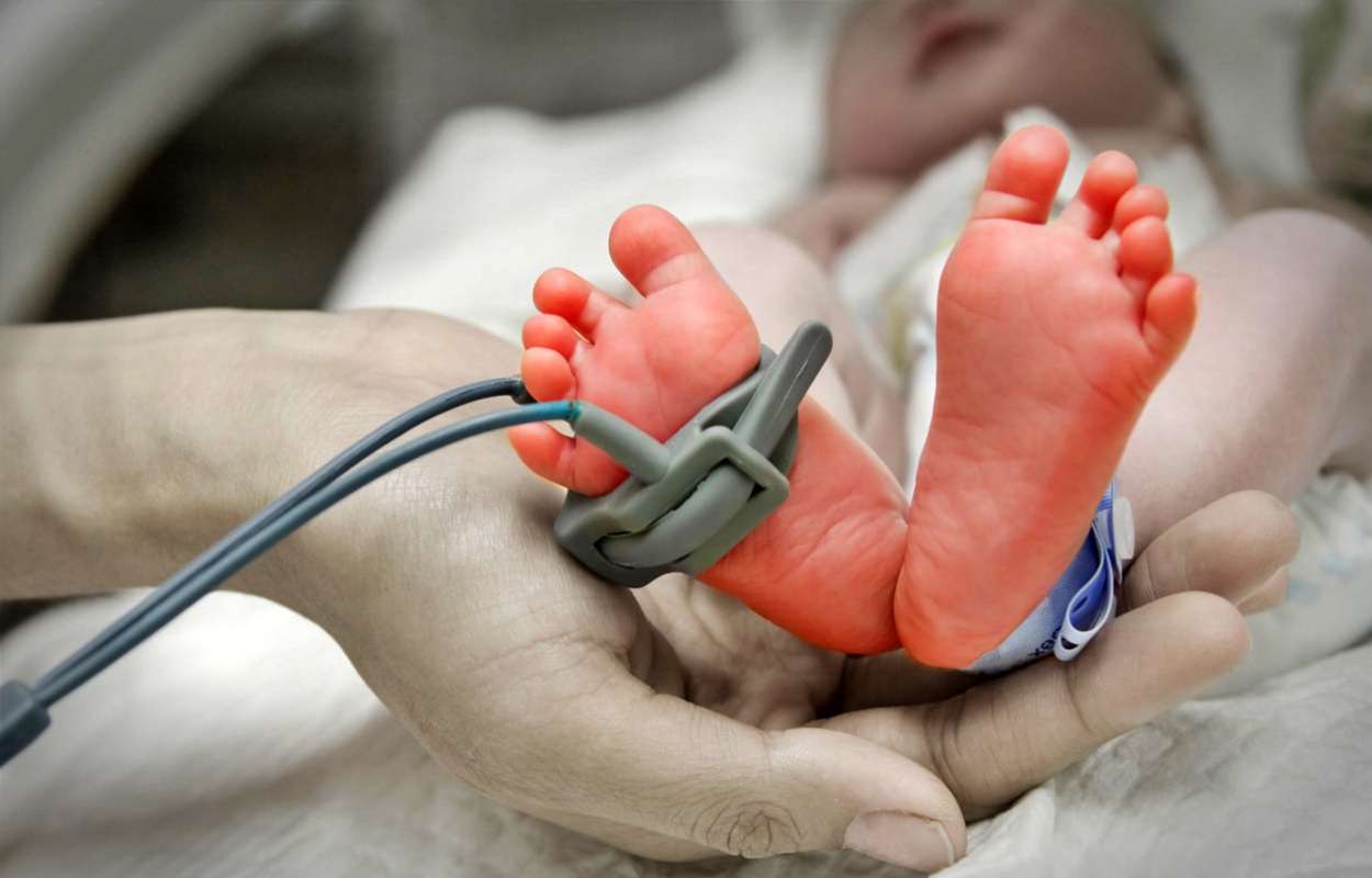 ilustrasi anak bayi dirawat di ruang PICU Rumah Sakit