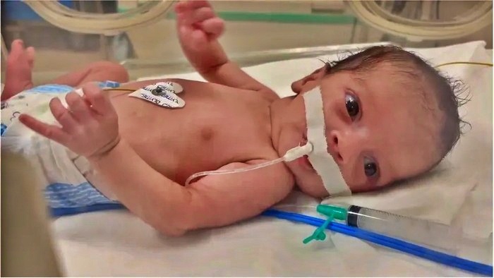 Nasib anak di Gaza jadi yatim piatu karena perang tak kunjung usai_foto BBC World