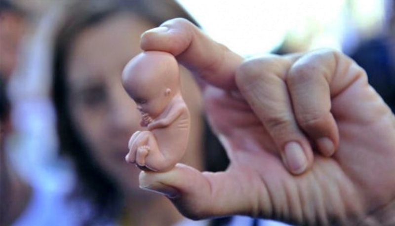 ilustrasi aborsi