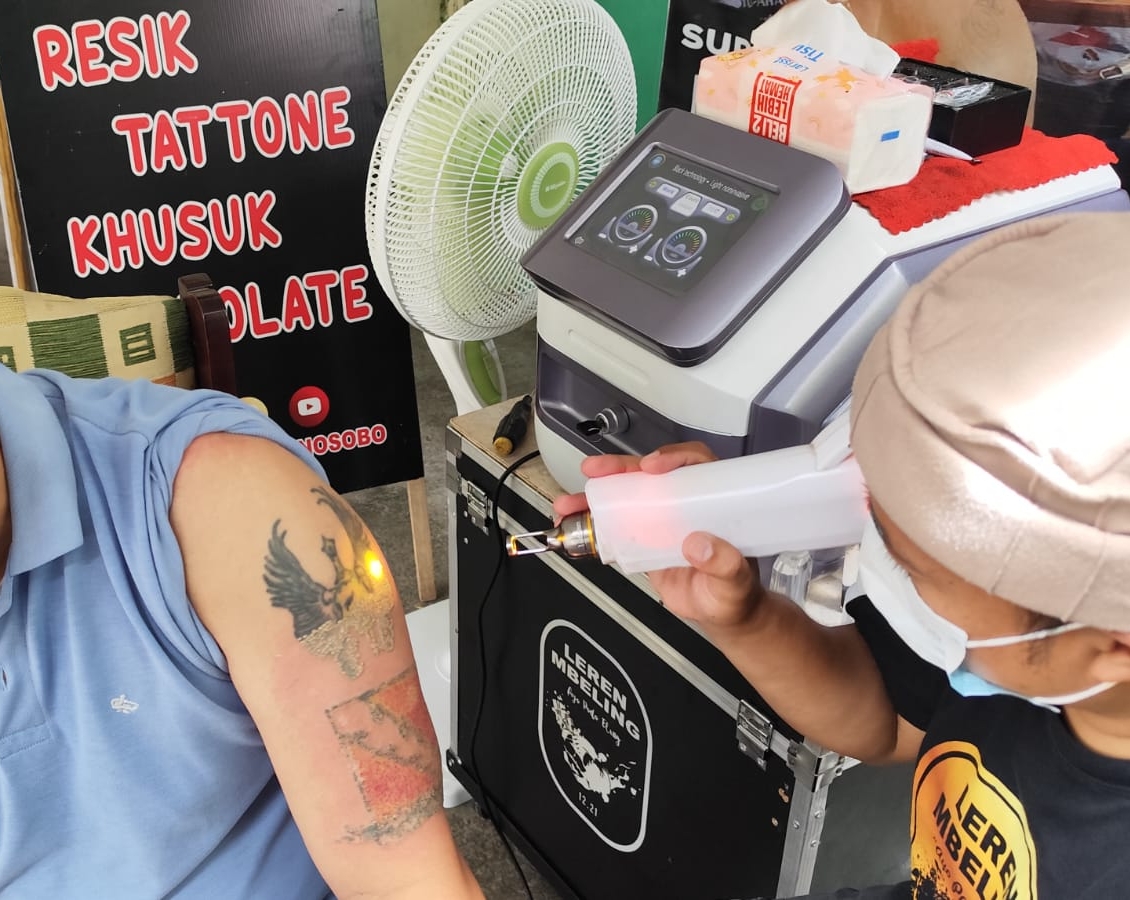 Majelis Hijrah Magelang Raya Gelar Program Hapus Tato Gratis