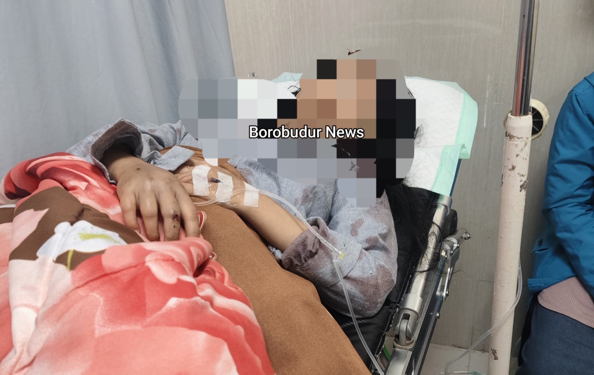 Kondisi korban penuh luka dan baju penuh darah, gadis di Kajoran diserang OTK di kamar rumahnya di Magelang (21/9/2026)